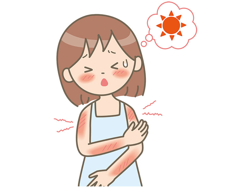 آلرژی به نور خورشید